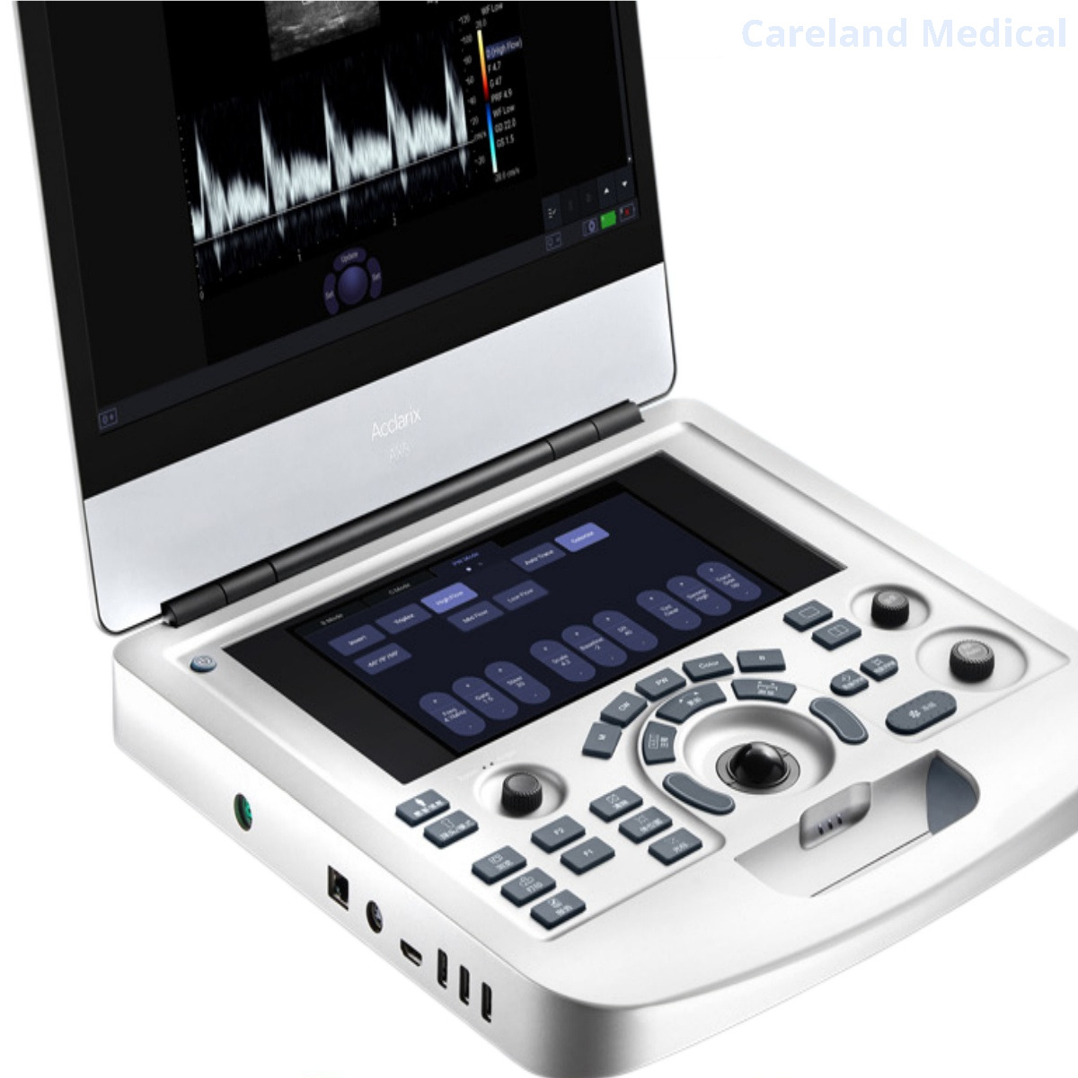 Portable Advanced 15" 3D 4D Echo Cardiac Mobile Fully Digital Diagnostic Ultrasound System Color Doppler Scanner Machine