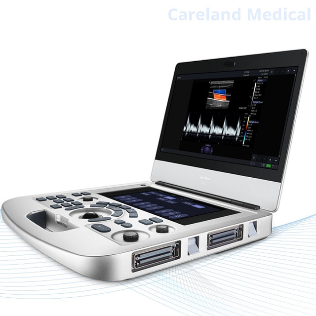 Portable Advanced 15" 3D 4D Echo Cardiac Mobile Fully Digital Diagnostic Ultrasound System Color Doppler Scanner Machine