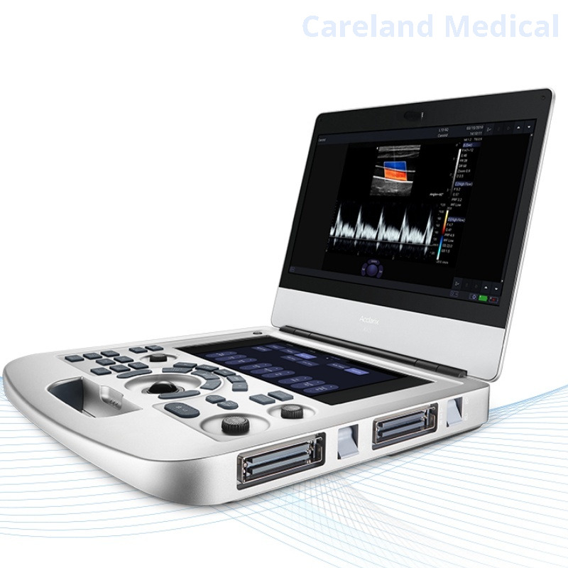 Portable Advanced 15" 3D 4D Echo Cardiac Mobile Fully Digital Diagnostic Ultrasound System Color Doppler Scanner Machine