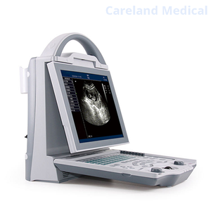 CL-3600 Portable Fully Digital Diagnostic Ultrasound Machine