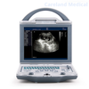 CL-3600 Portable Fully Digital Diagnostic Ultrasound Machine