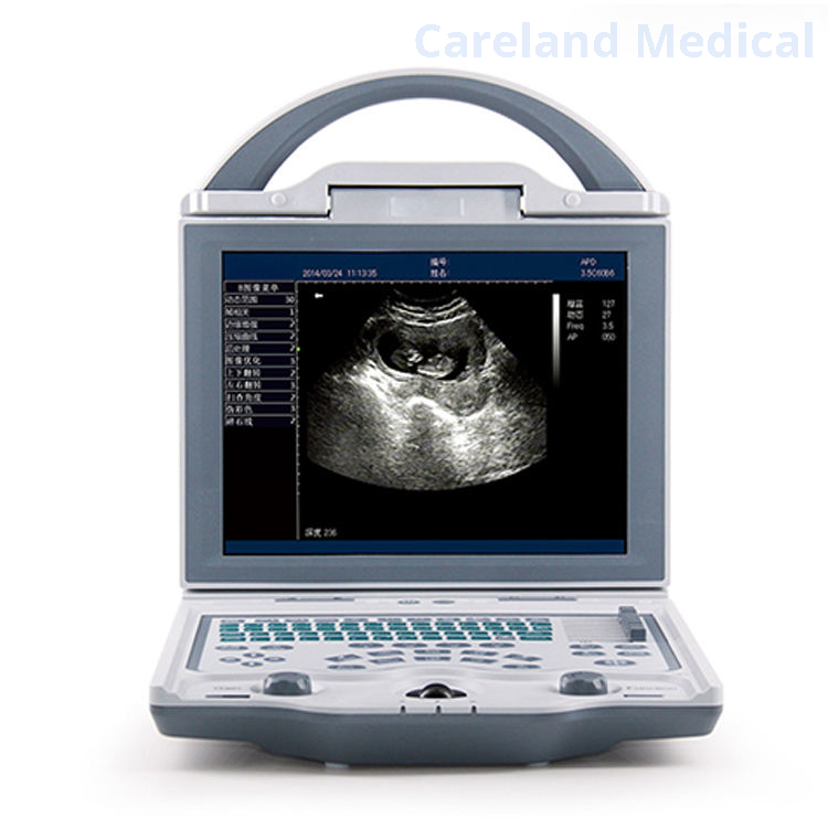 CL-3600 Portable Fully Digital Diagnostic Ultrasound Machine