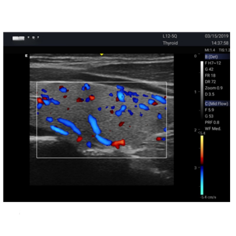 Portable Advanced 15" 3D 4D Echo Cardiac Mobile Fully Digital Diagnostic Ultrasound System Color Doppler Scanner Machine